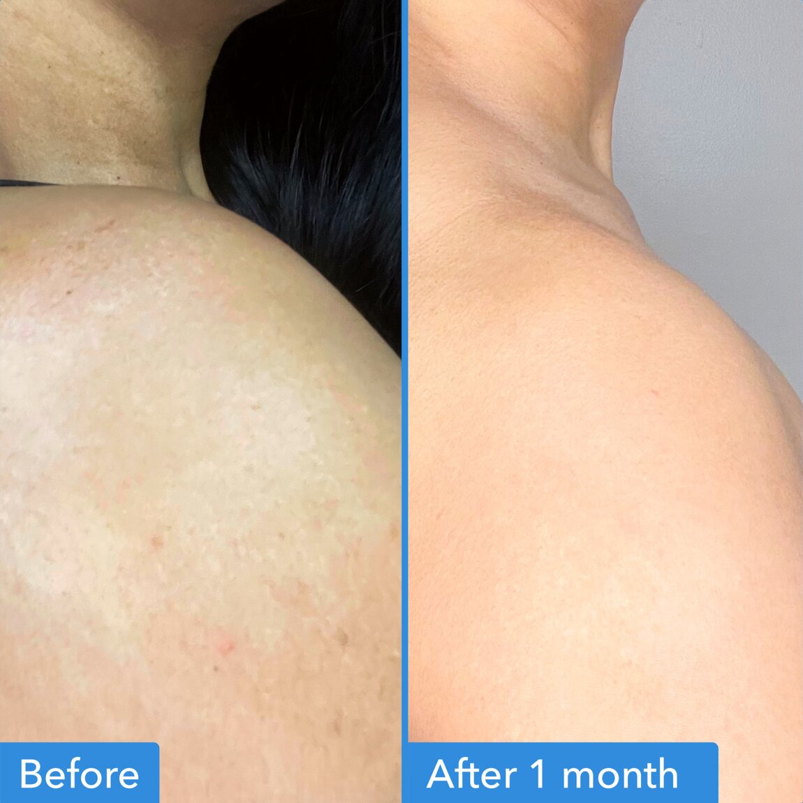 discoloration-correcting-body-treatment-o9 zb_p.jpg