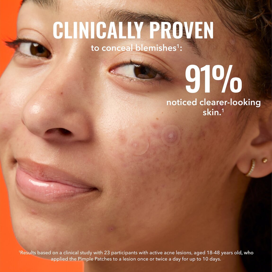pimple-patches-m2 zb_p.jpg
