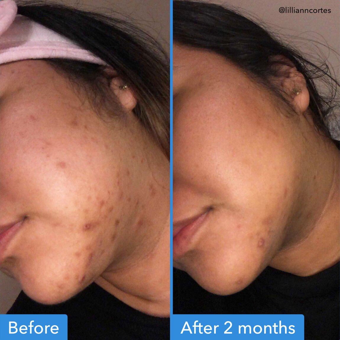 discoloration-correcting-serum-d4 zb_p.jpg
