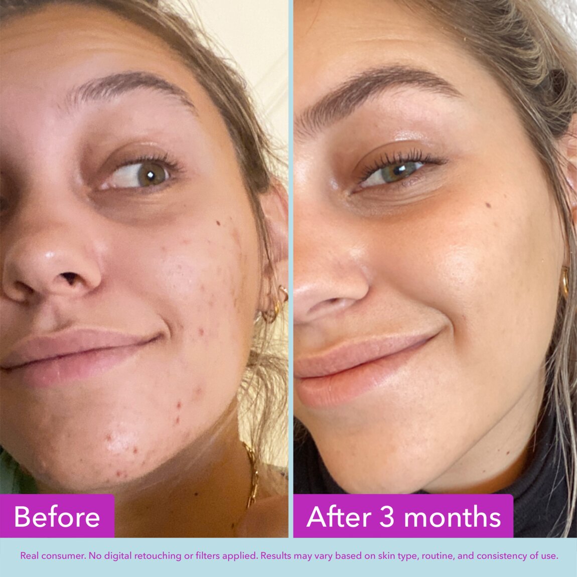 niacinamide-brightening-toner-w1 zb_p.jpg